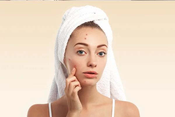 The Negative Effects of Humidity on Skin